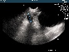  - Ultrasound confirmation